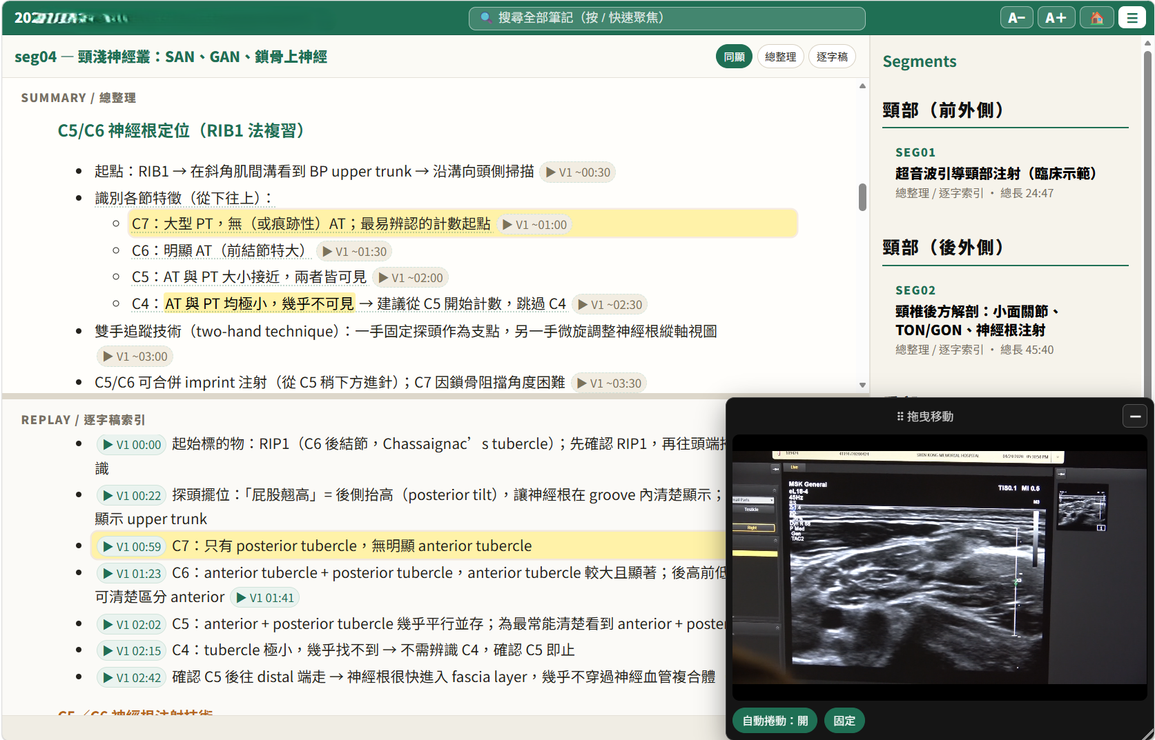 同步視圖：總整理與逐字稿索引並排，浮動影片視窗可拖曳，高亮條目跟著影片走