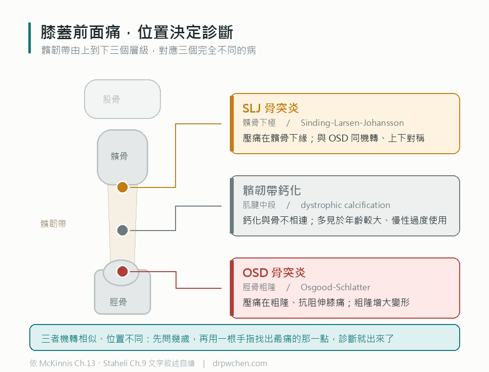膝前疼痛三個位置的鑑別：髕骨下極是 SLJ 骨突炎、肌腱中段是髕韌帶鈣化、脛骨粗隆是 Osgood-Schlatter 骨突炎